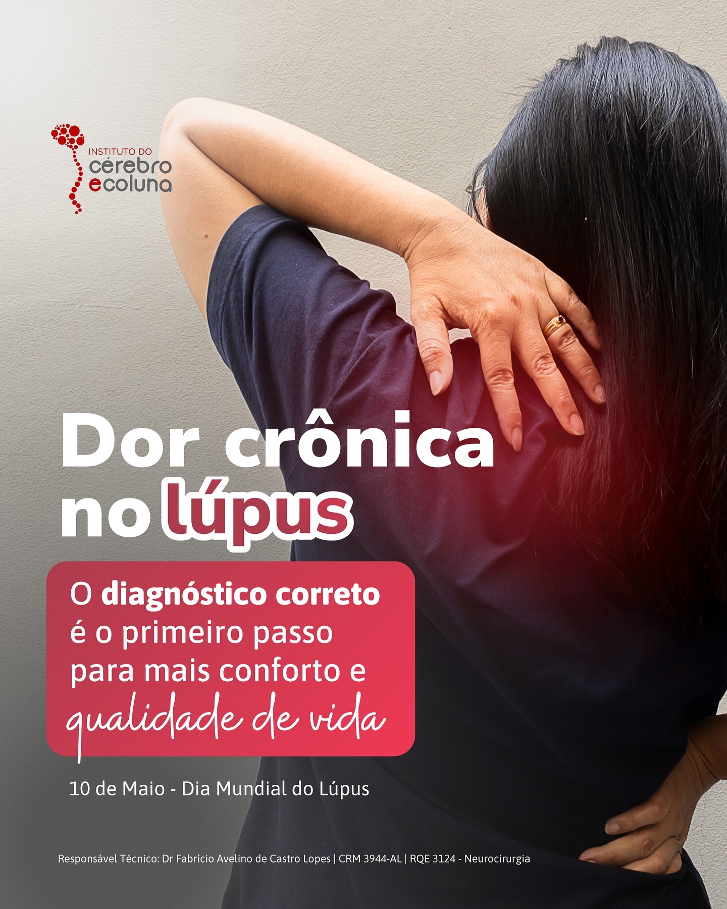 Dor crônica no  Lúpus