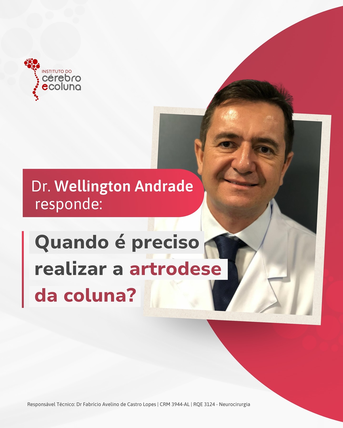 Quando é preciso realizar a artrodese da coluna?