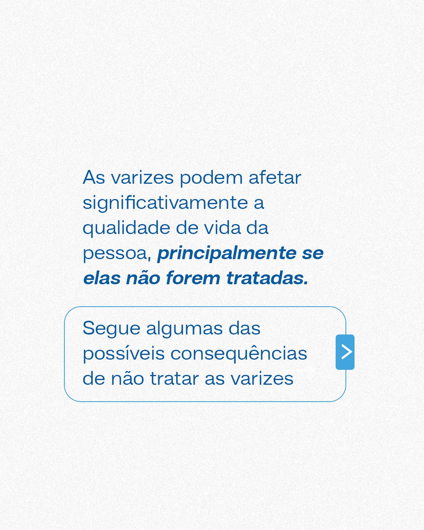 Não deixe que as varizes atrapalhem sua qualidade de vida.