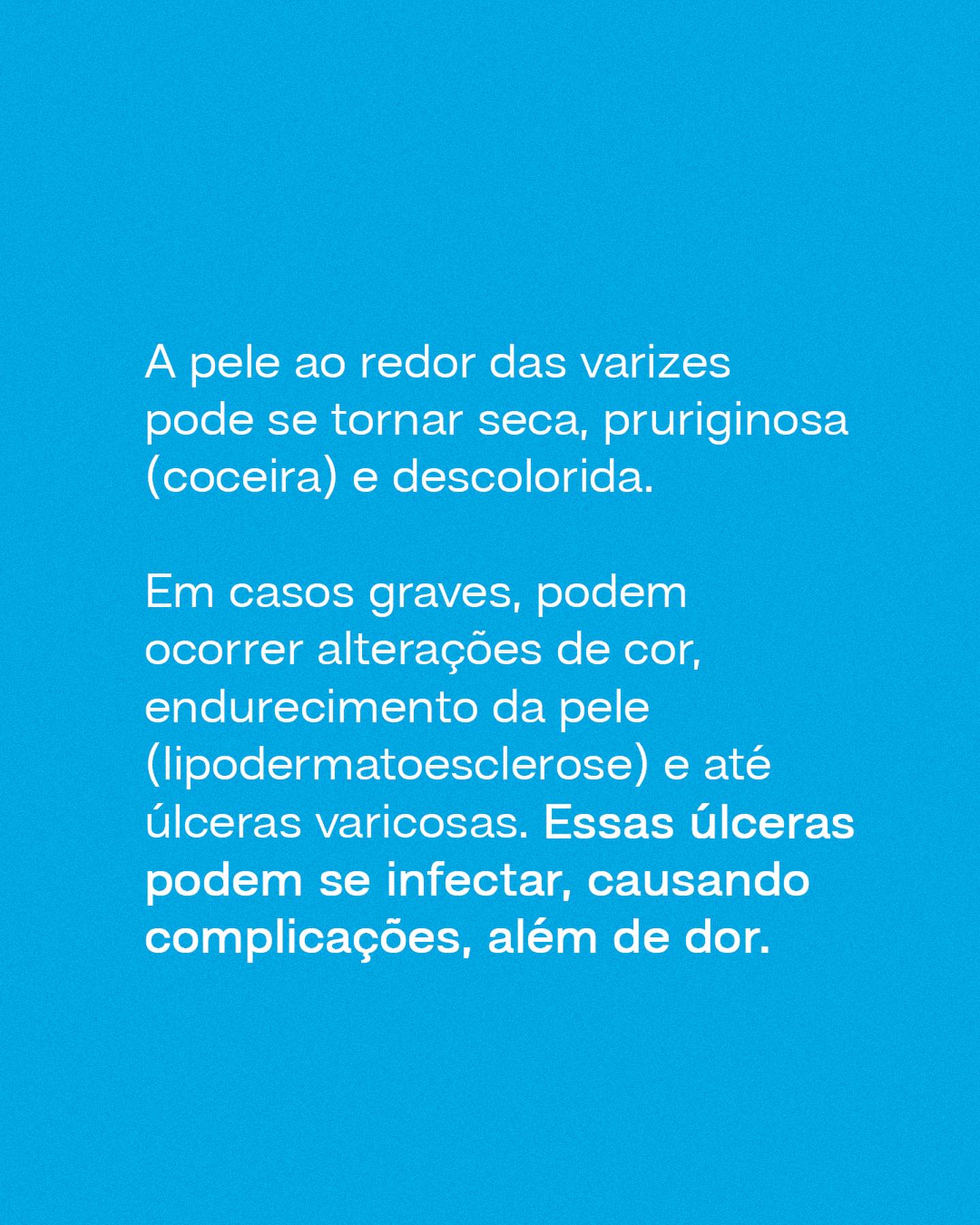 Não deixe que as varizes atrapalhem sua qualidade de vida.