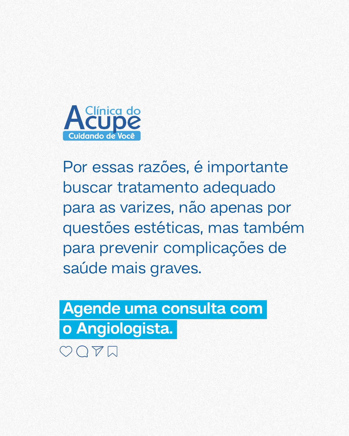 Não deixe que as varizes atrapalhem sua qualidade de vida.