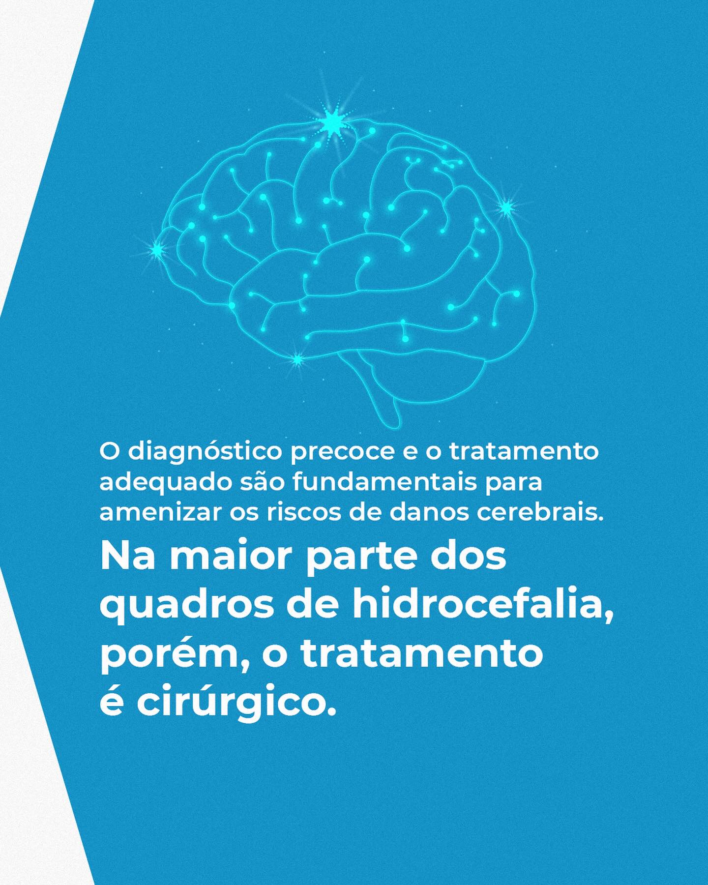 O que é a Hidrocefalia?