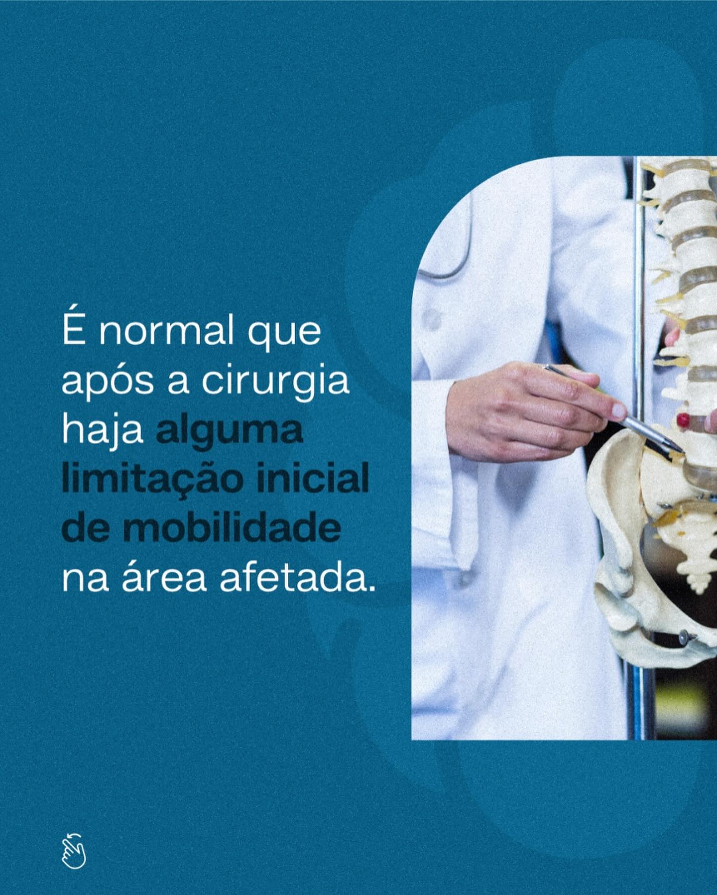 Após a cirurgia terei a mobilidade da coluna afetada.