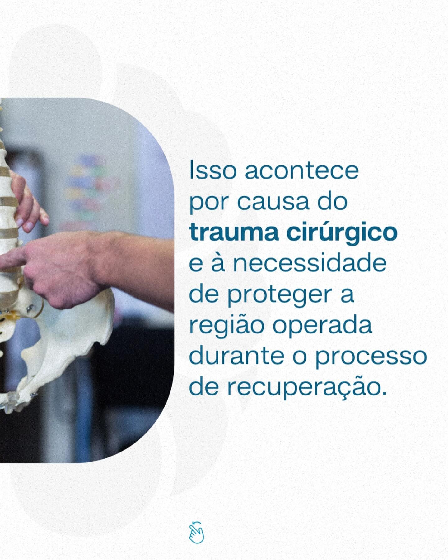 Após a cirurgia terei a mobilidade da coluna afetada.