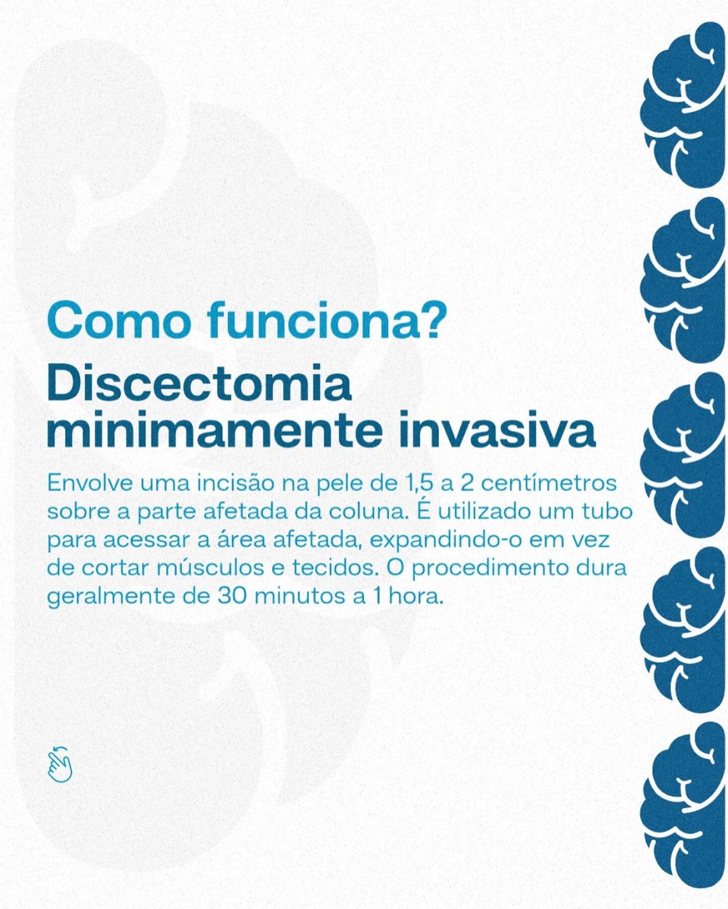 Discectomia como funciona?
