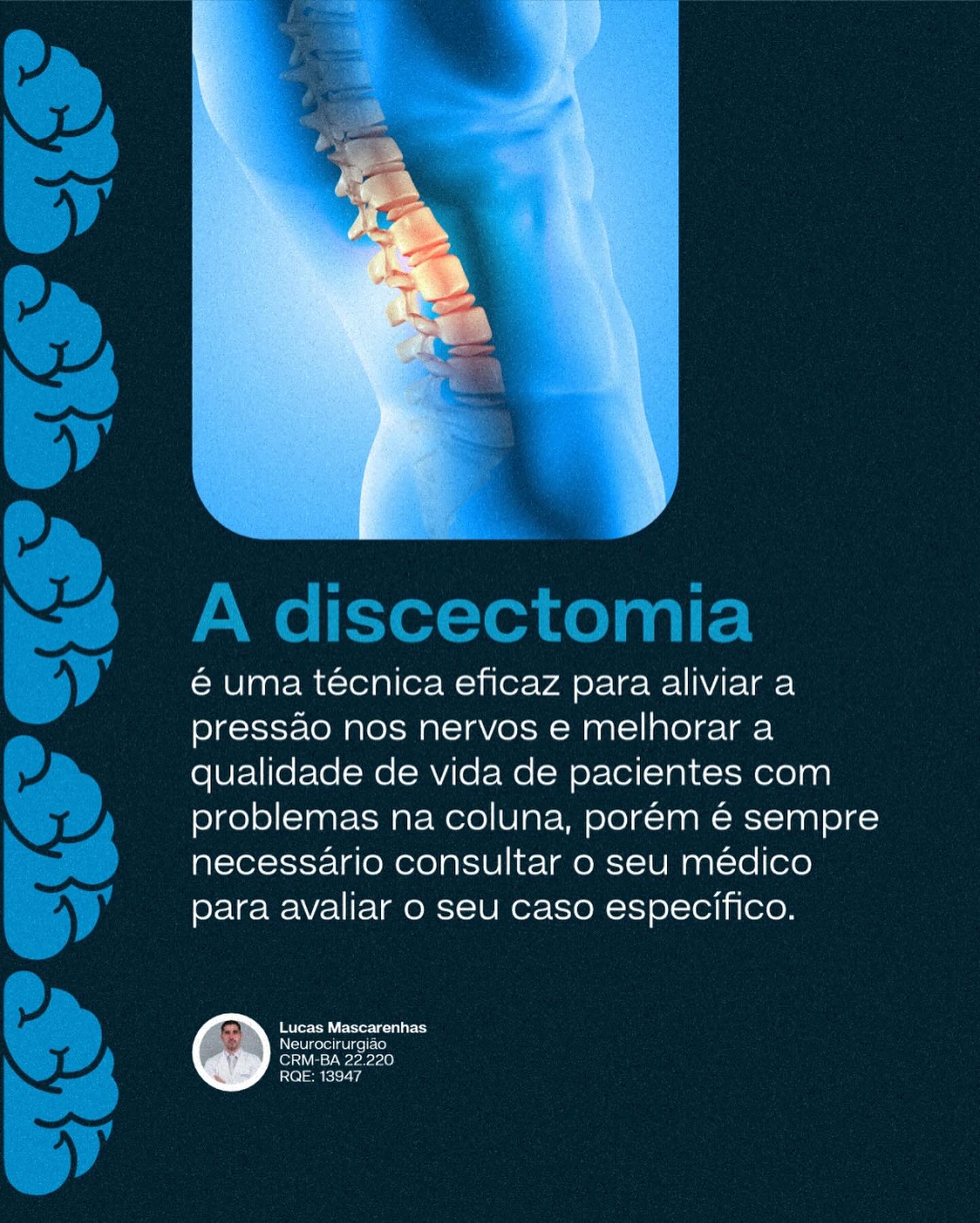 Discectomia como funciona?