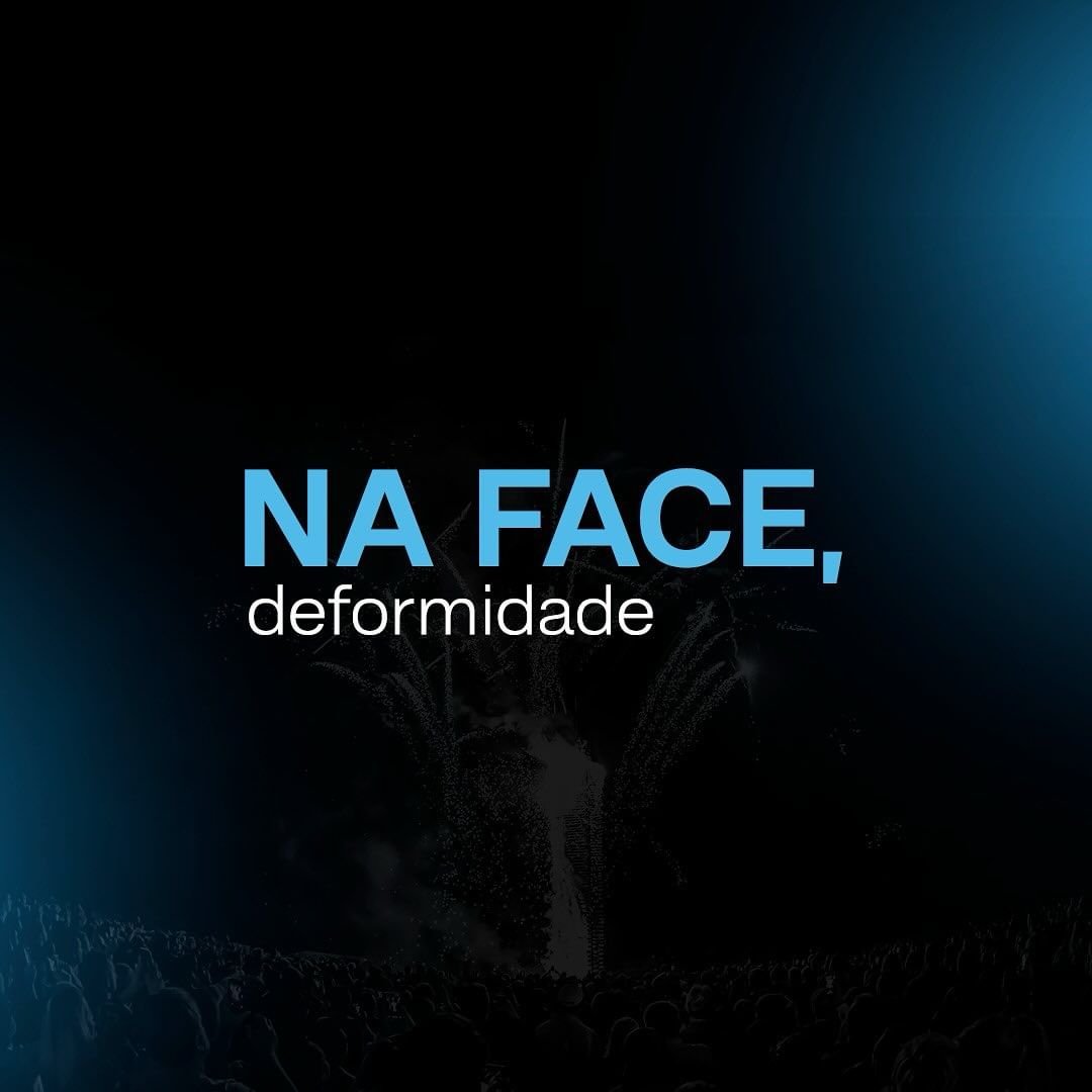 Queimaduras são sérias e podem ter consequências devastadoras.