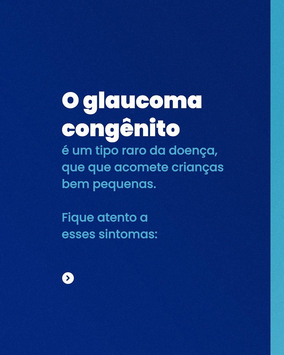 O glaucoma é uma doença crônica, ou seja, não tem cura. Felizmente há tratamento!
