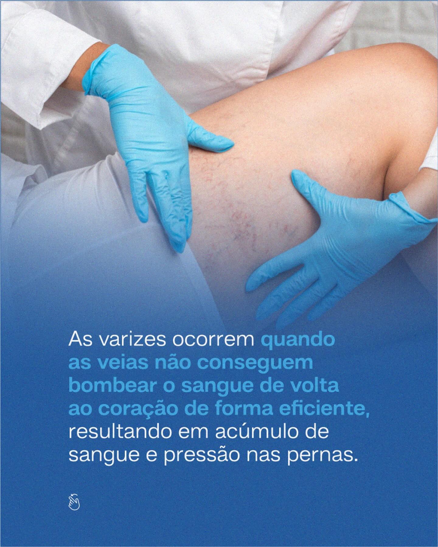 Não ignore o desconforto! Agende uma consulta e descubra como cuidar melhor da sua saúde vascular.