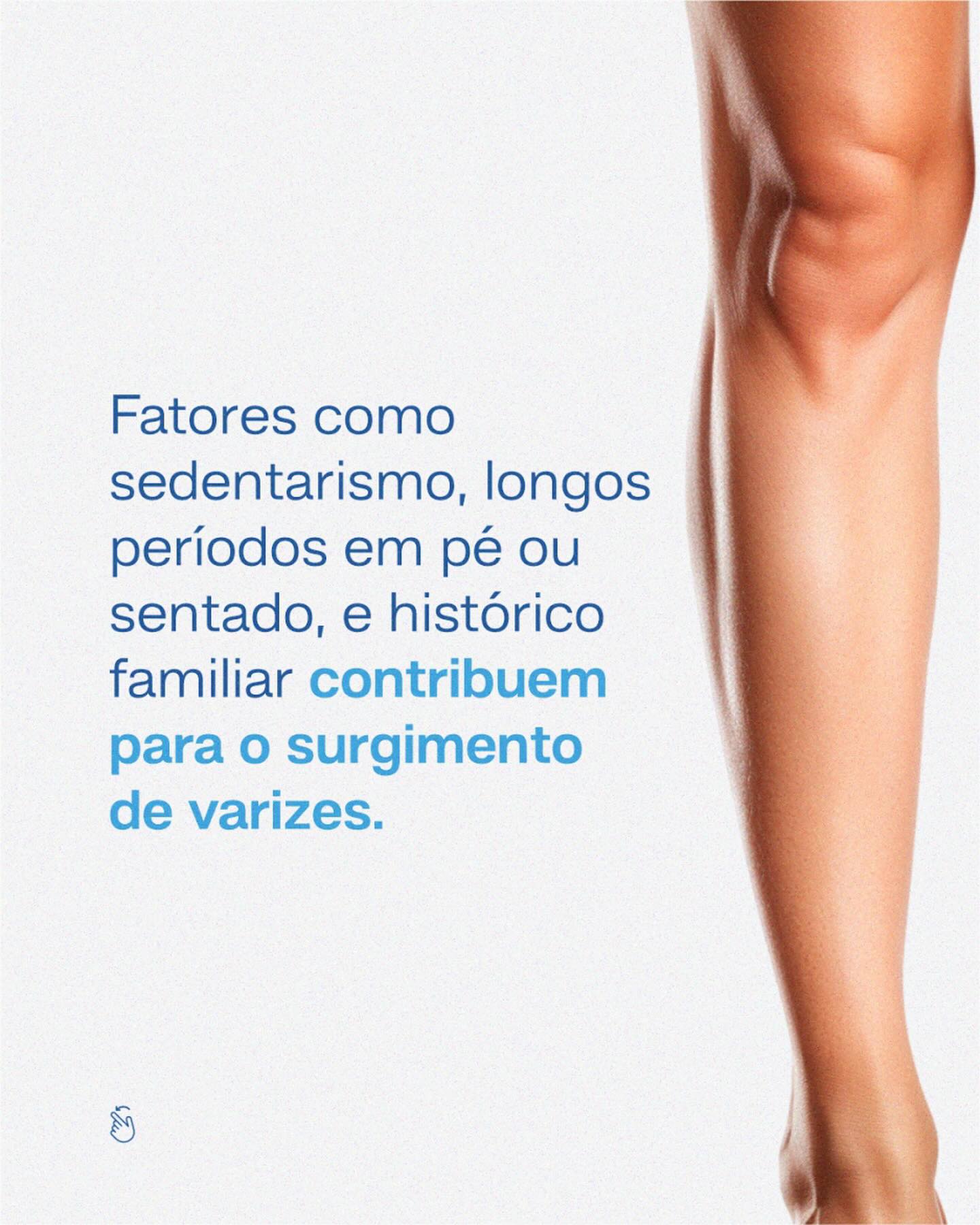 Não ignore o desconforto! Agende uma consulta e descubra como cuidar melhor da sua saúde vascular.
