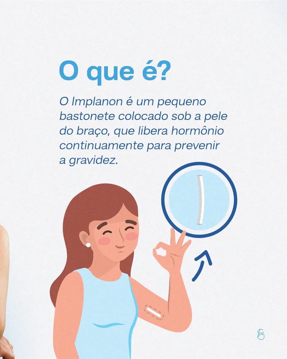 Agende sua consulta e descubra se o Implanon é a melhor opção para você. Sua saúde merece essa atenção!