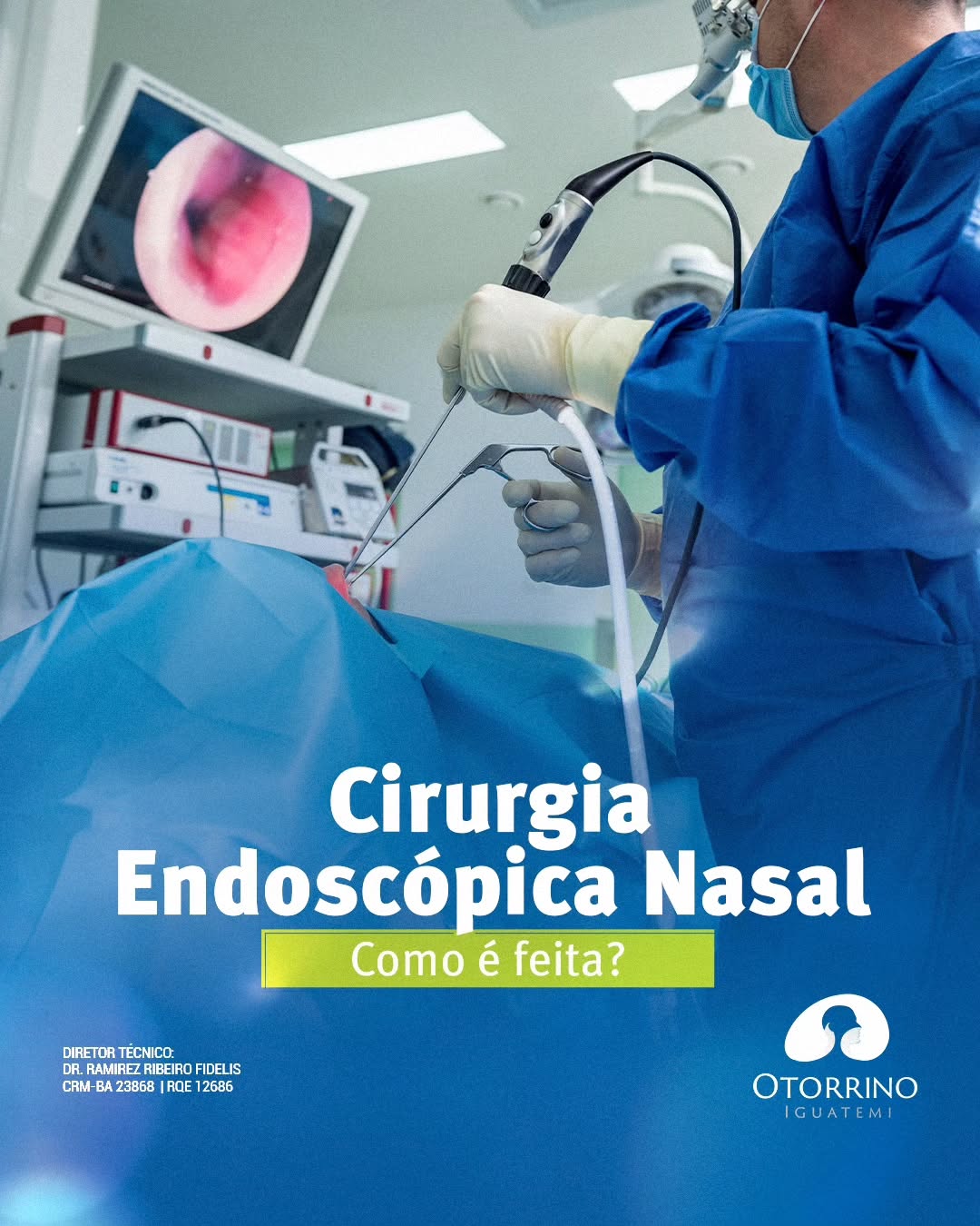 Cirurgia endoscópica nasal como é feita?