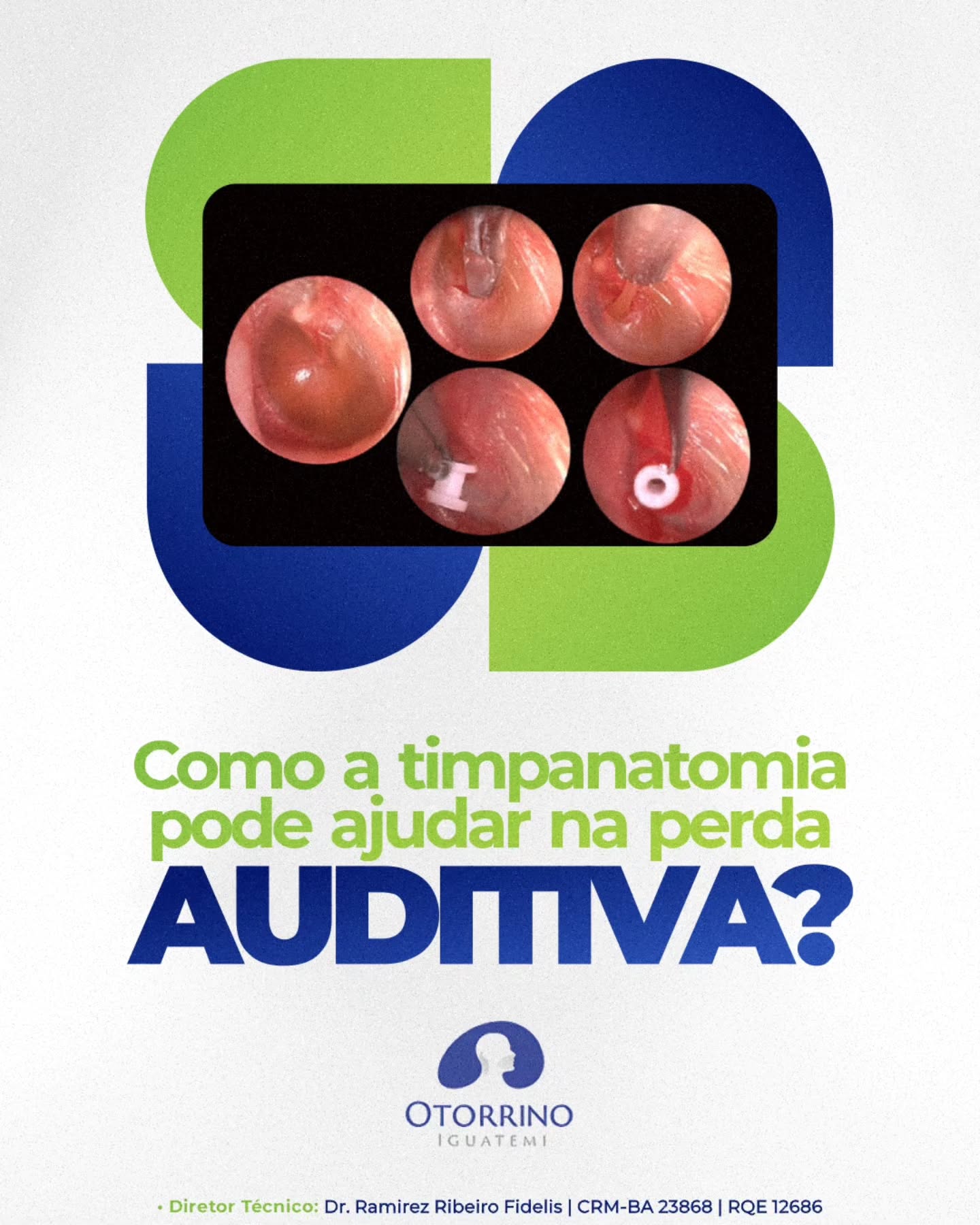 Quanto mais cedo o diagnóstico for feito, maiores são as chances de um tratamento bem-sucedido!