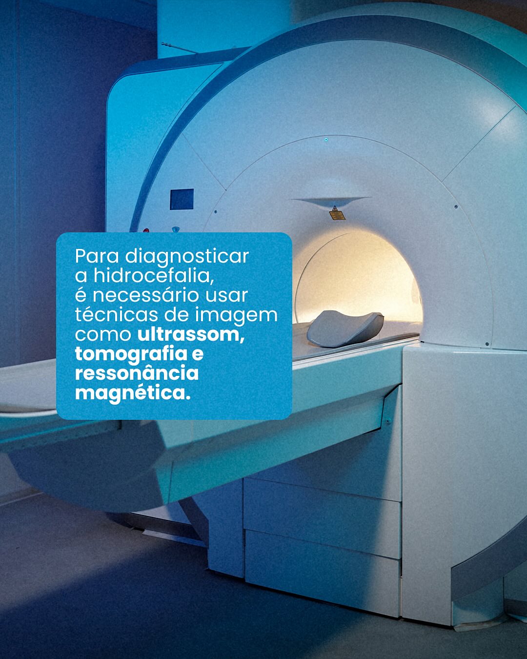 Hidrocefalia  uma condição silenciosa que requer atenção.
