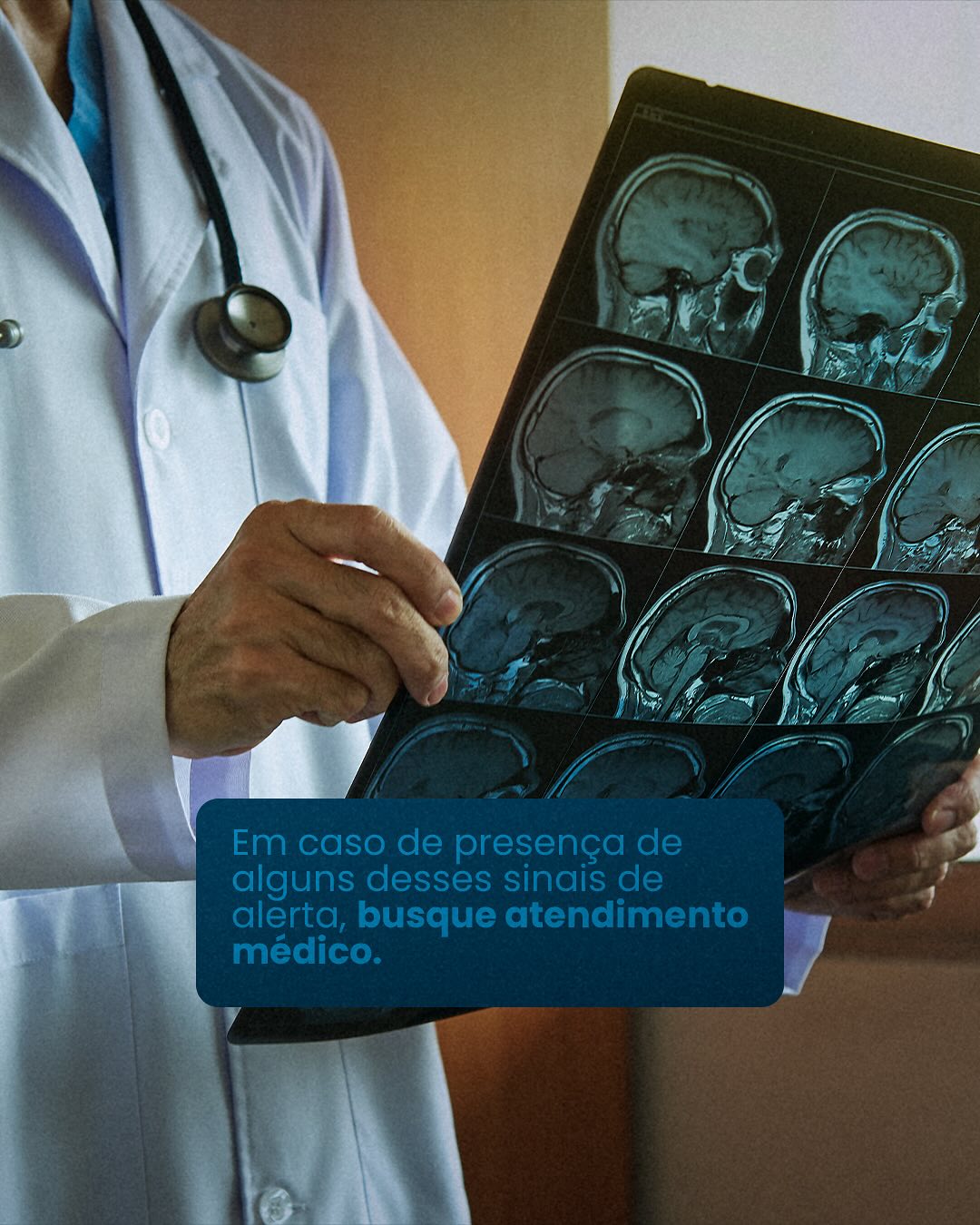Hidrocefalia  uma condição silenciosa que requer atenção.