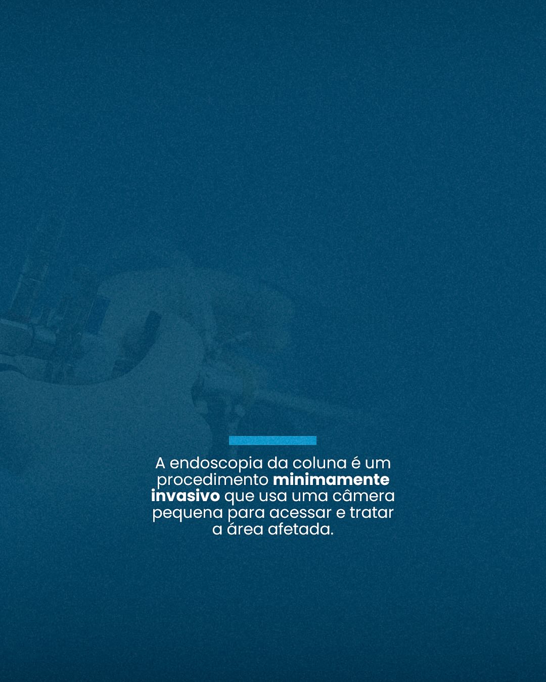 Compressões nervosas