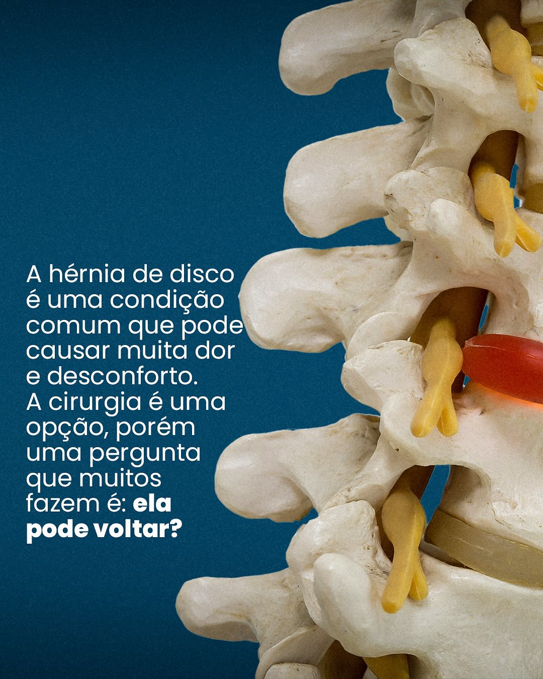 Compartilha essa informação com mais pessoas!