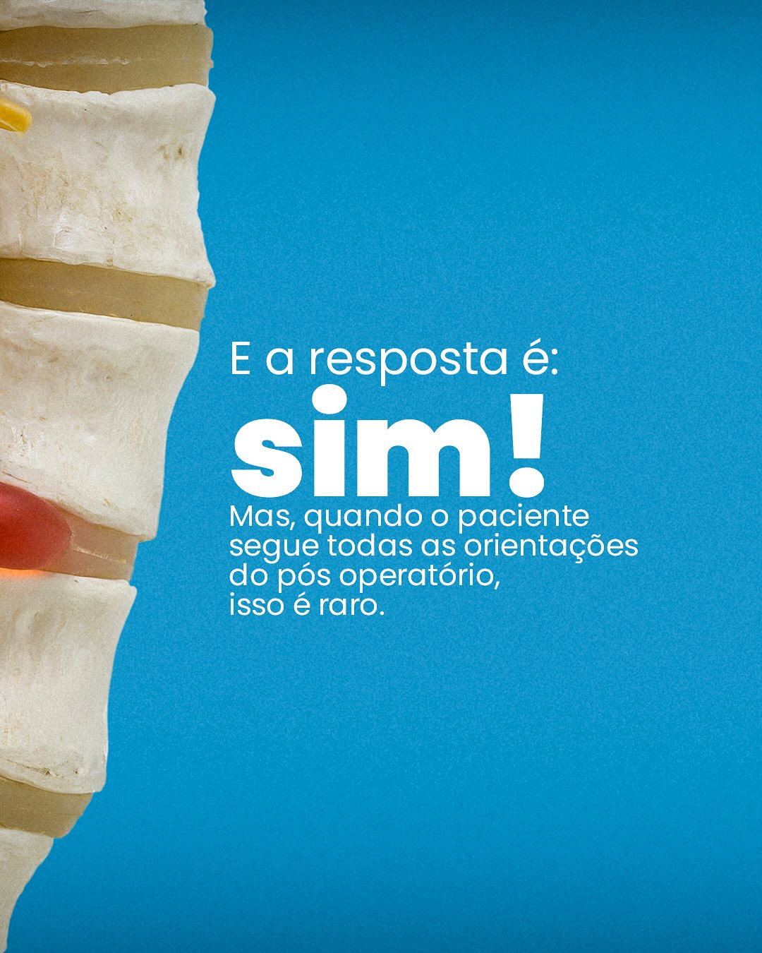 Compartilha essa informação com mais pessoas!