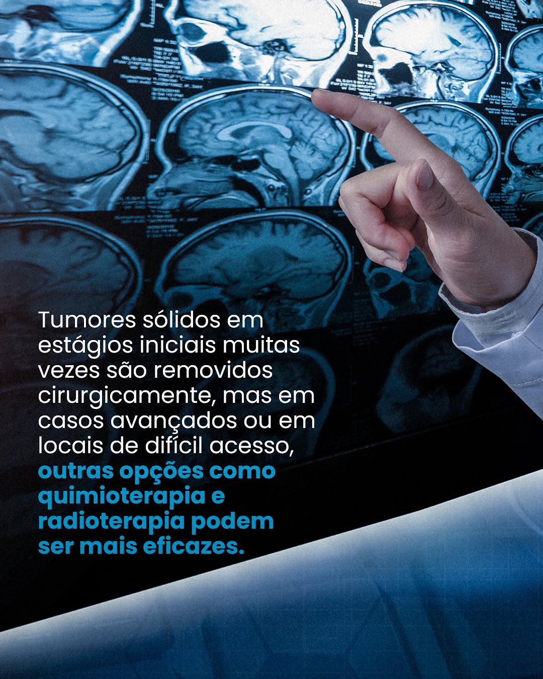Todos os tumores são cirúgicos?
