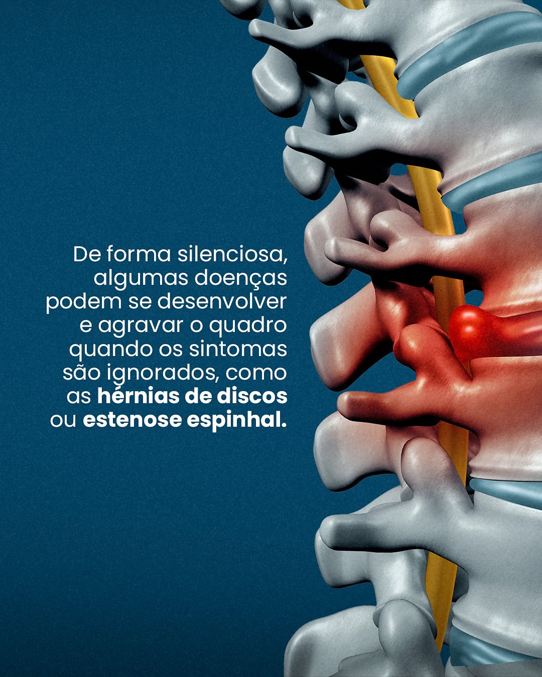 Suas dores nas costas nem sempre são causadas por má postura.