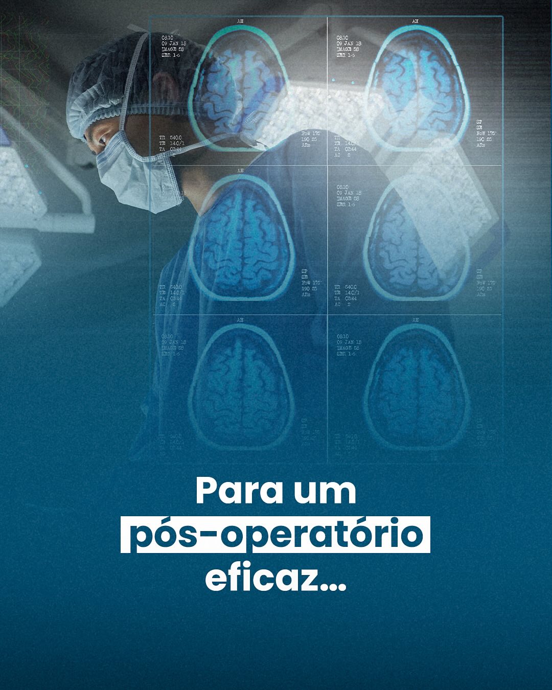 Cuidados  pós cirúrgicos- O Caminhao Para a Recuperação Cerebral