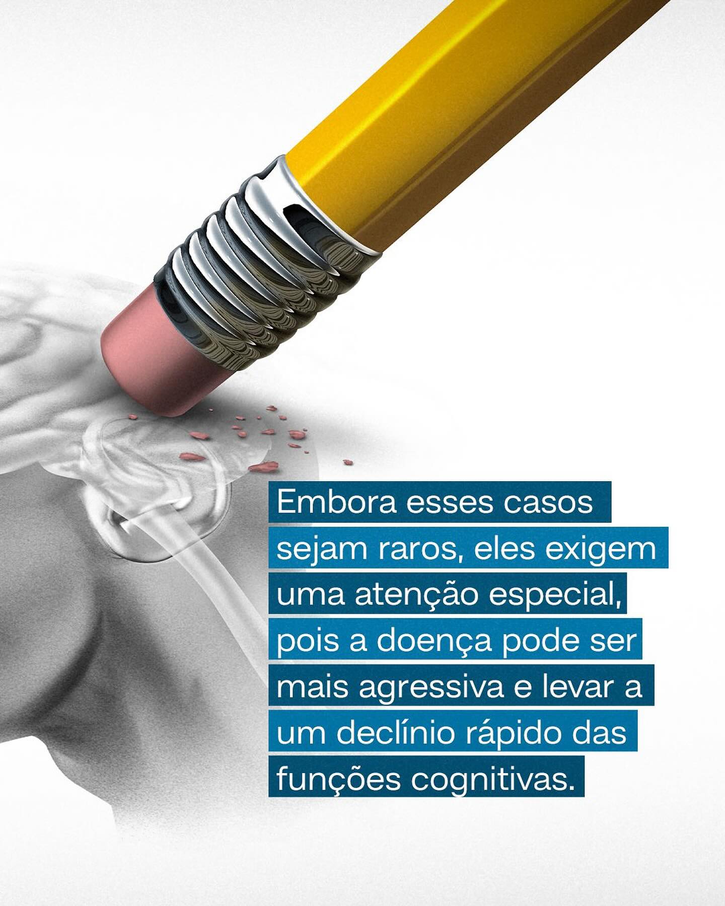 O Alzheimer só atinge idosos?