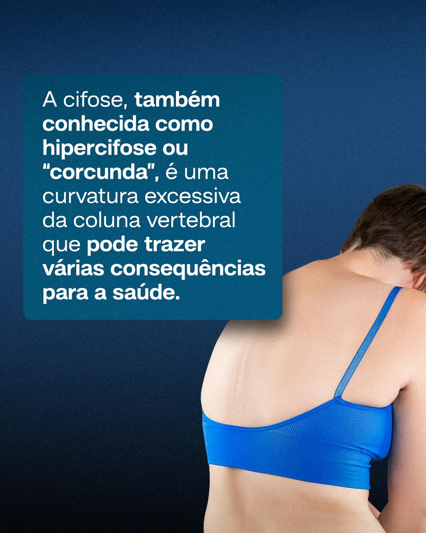 Manter uma boa postura e fazer exercícios ajudam a prevenir e tratar a cifose.