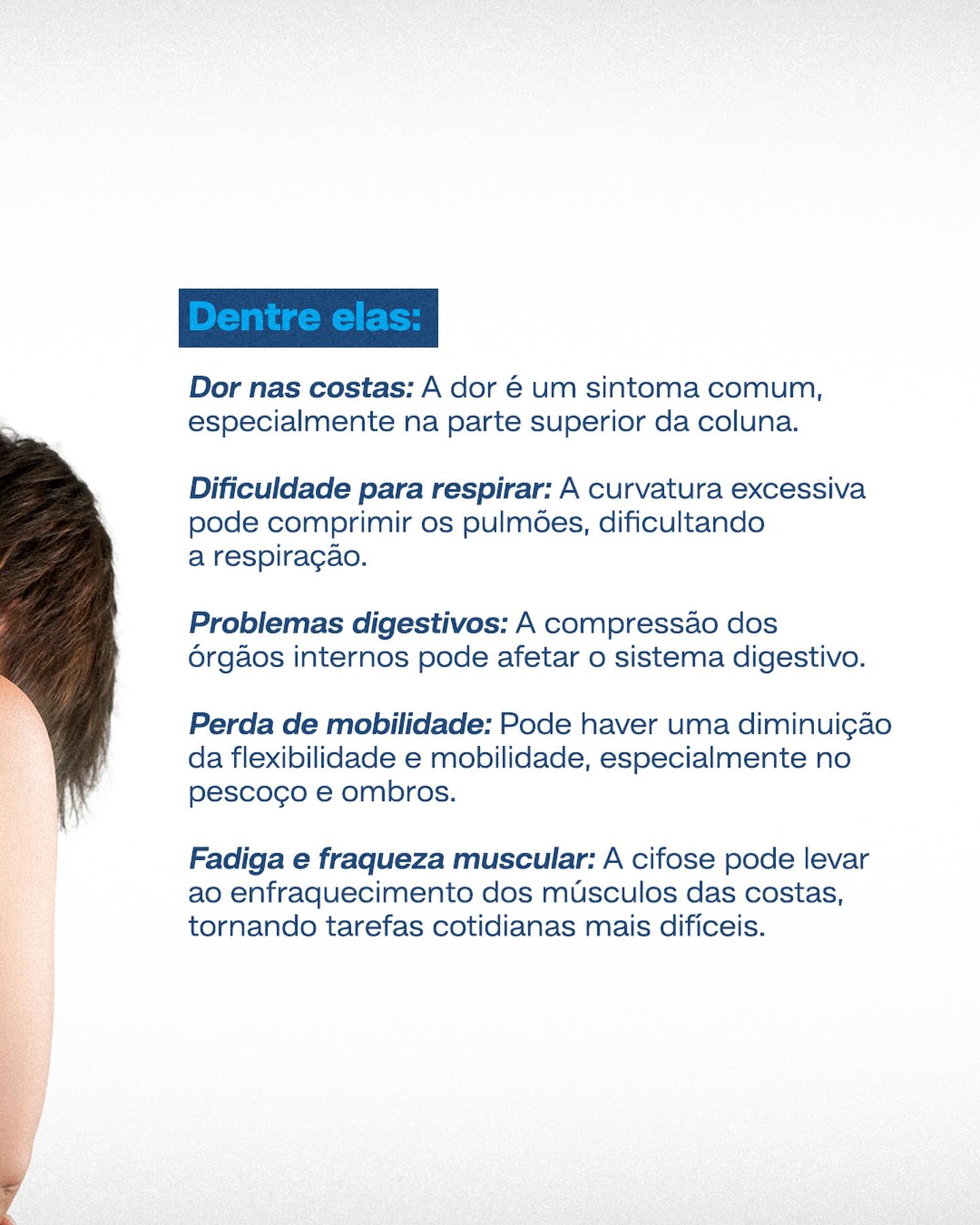 Manter uma boa postura e fazer exercícios ajudam a prevenir e tratar a cifose.