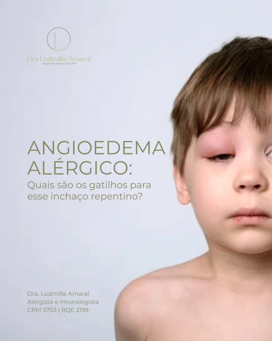 Angiodema Alérgico: Quais são os gatilhos para esse inchaço repentino?