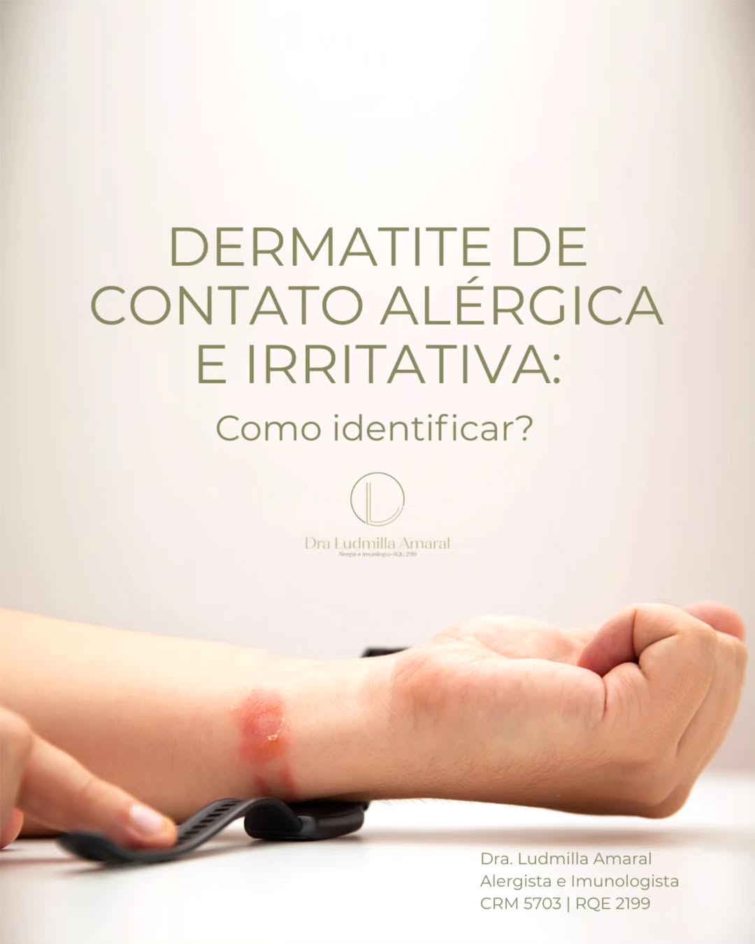 Dermatite de Contato Alérgica e Irritativa: Como identificar?