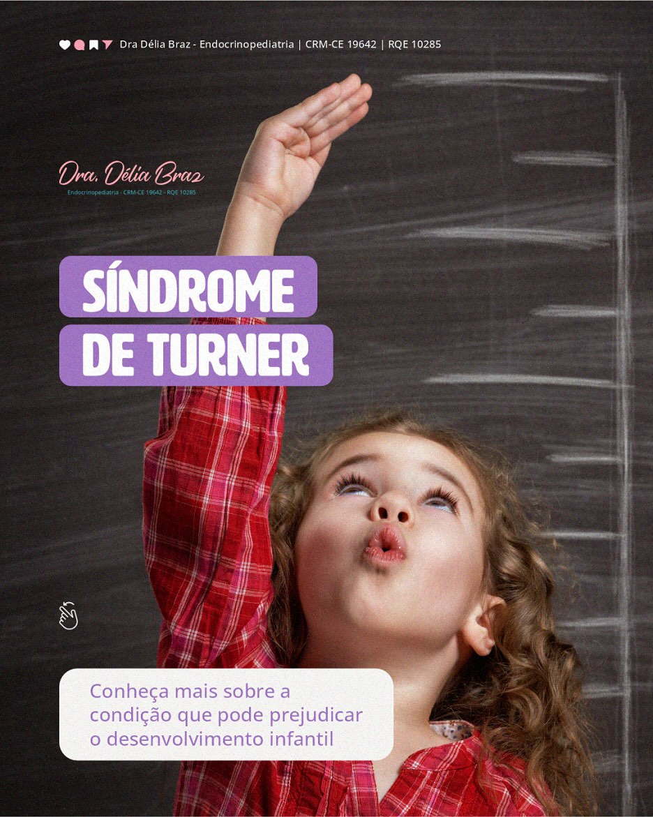 Síndrome Turner