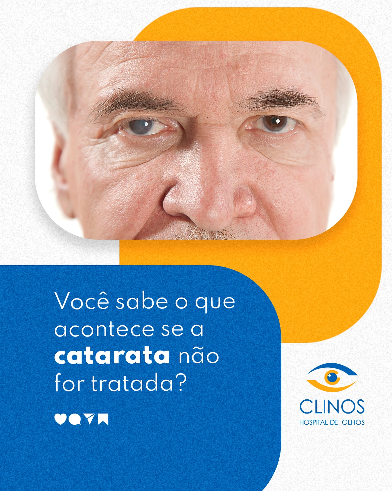 Se notar alguma mudança na visão, não espere: procure um especialista!