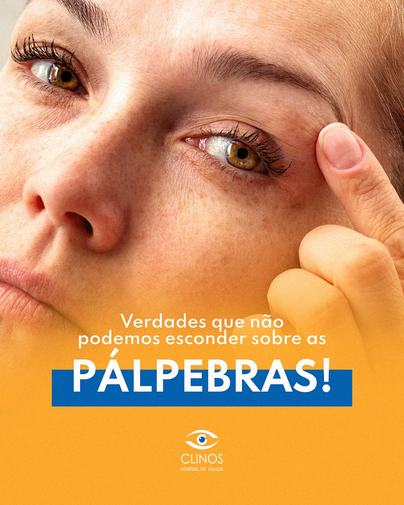 Está na hora de agendar uma consulta para cuidar das suas pálpebras!
