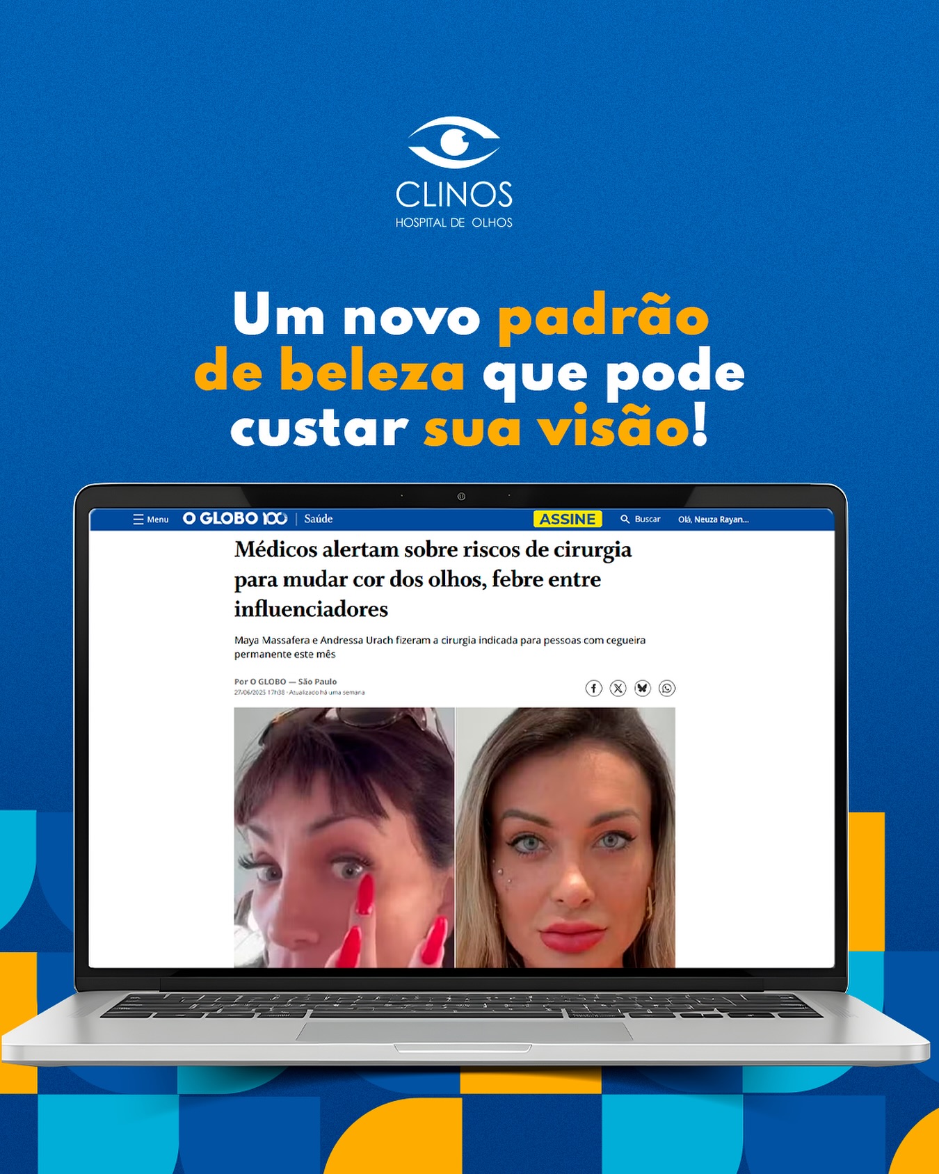 Cuidar da saúde dos olhos deve ser algo visto com carinho.