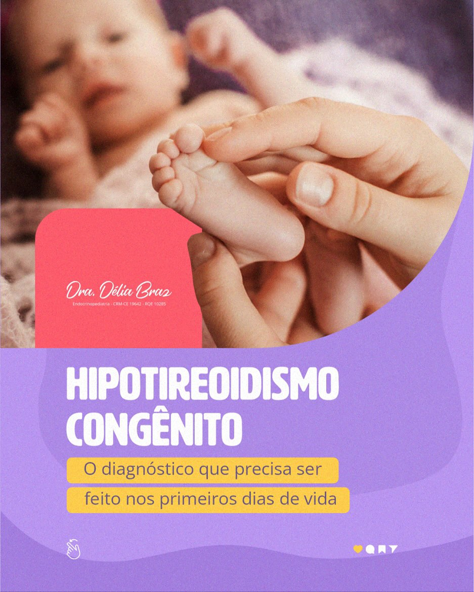Hipotireoidismo Congênito. O diagnóstico que precisa ser feiro nos primeiros dias de vida