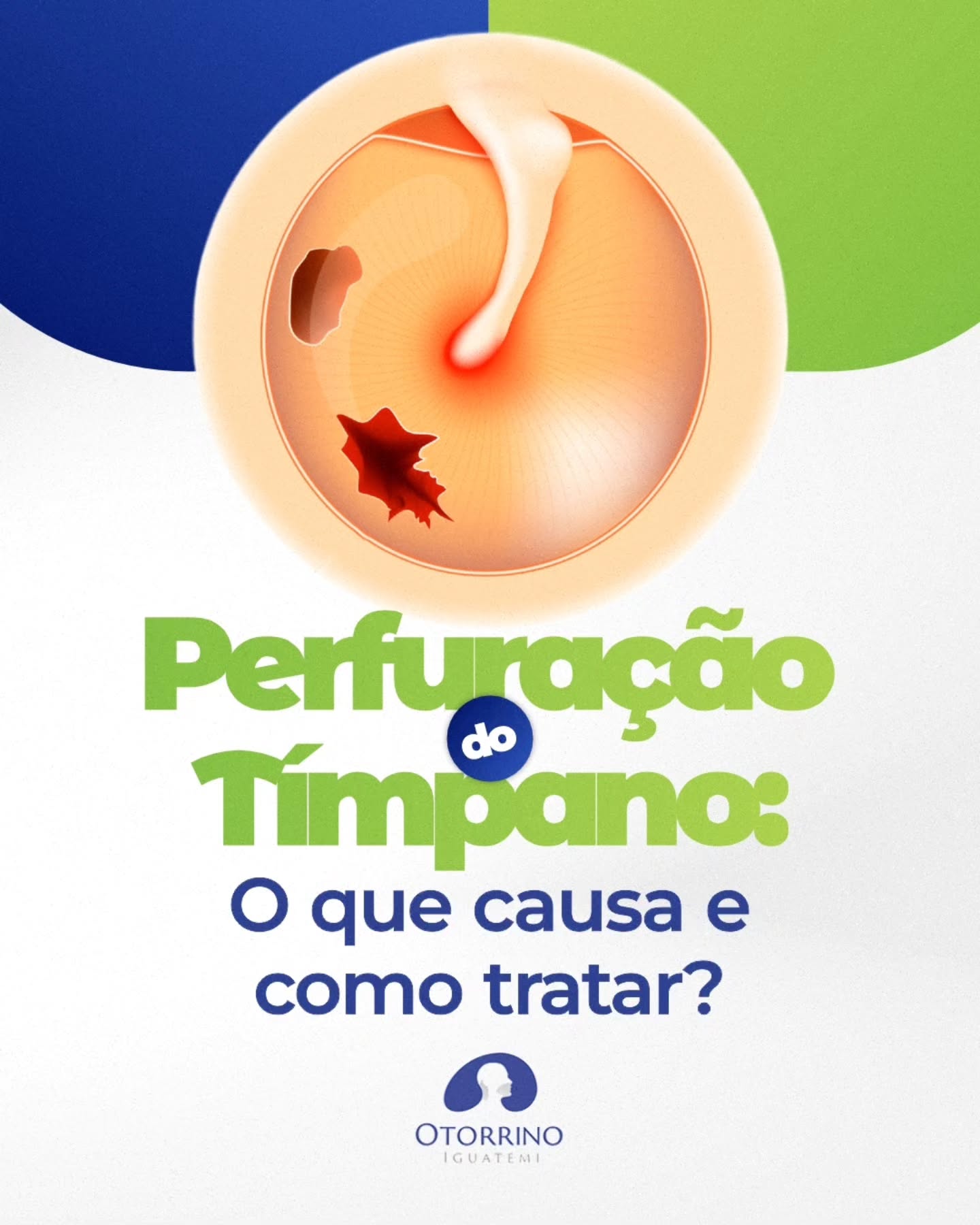 Aqui na Otorrino Iguatemi, você encontra um atendimento humanizado, com todo o cuidado que seus ouvidos merecem.