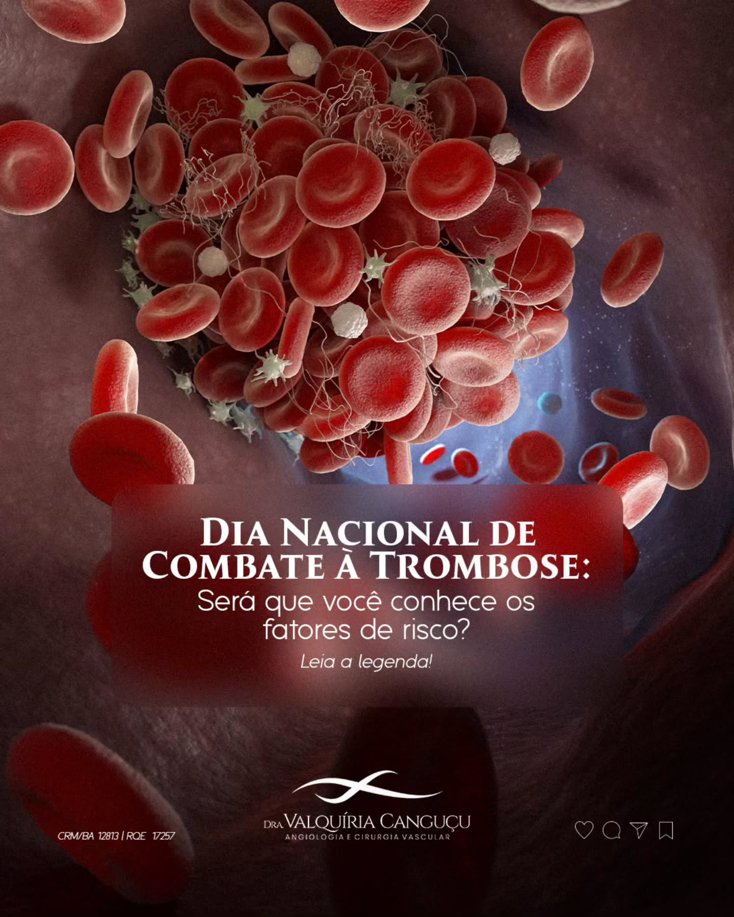 Dia Nacional de Combate à Trombose