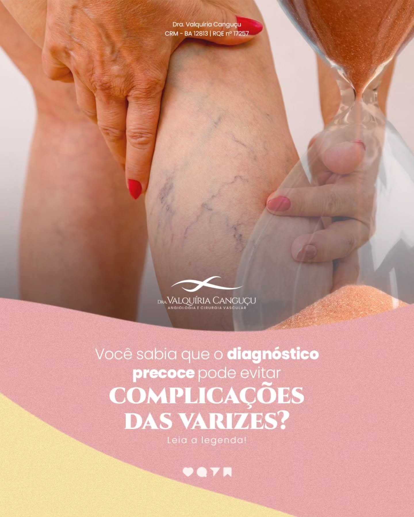 Você sabia que o diagnóstico precoce pode evitar complicações das varizes?