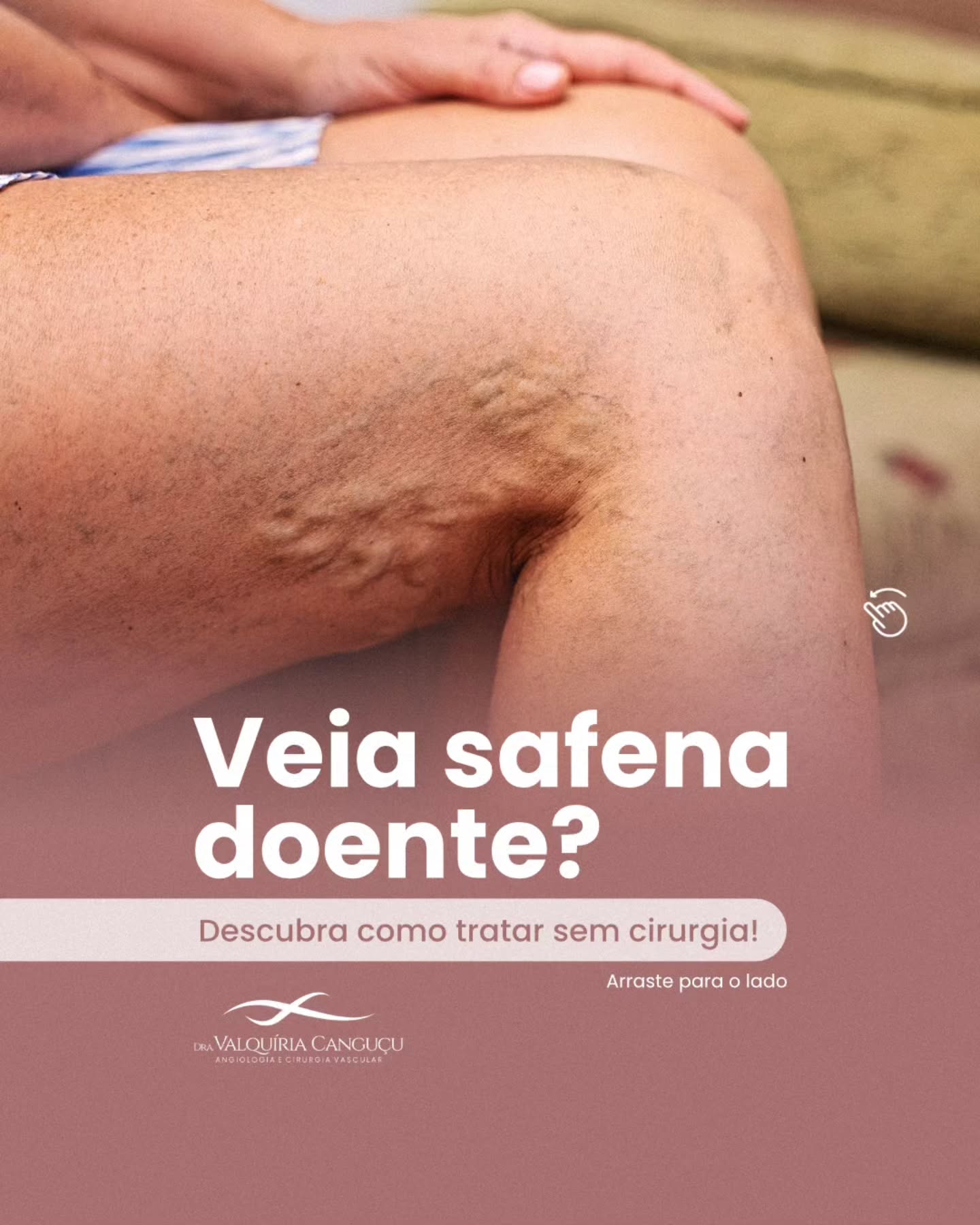 Você sonha em tratar sua veia safena sem cirurgia?