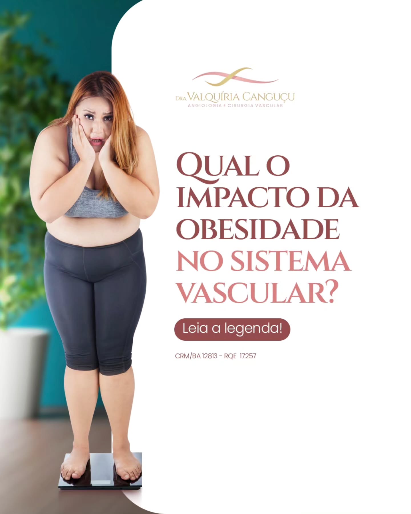 angiologista #saudevascular #varizes #trombose #pesoideal