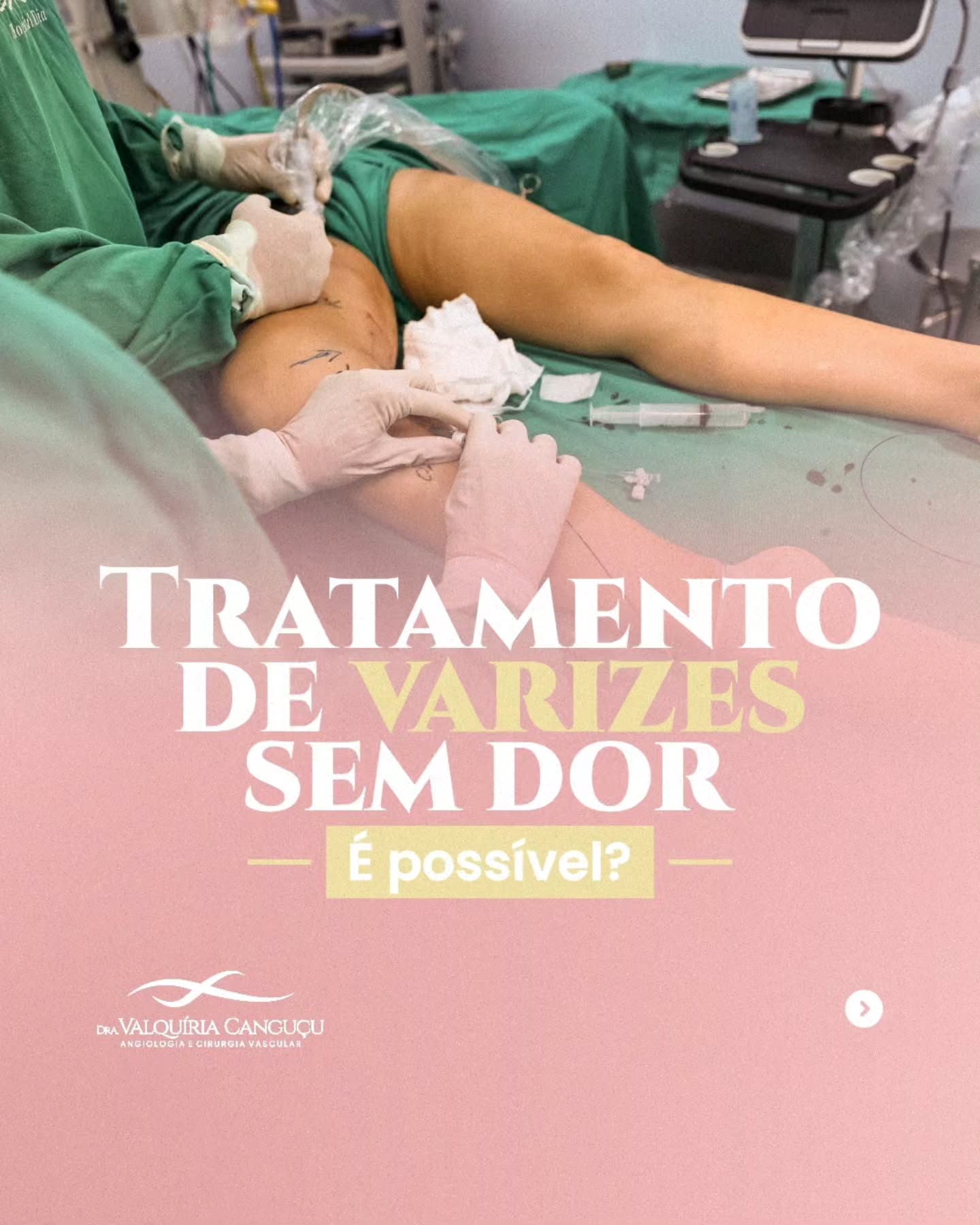 Já imaginou tratar varizes sem sentir dor ou desconforto?