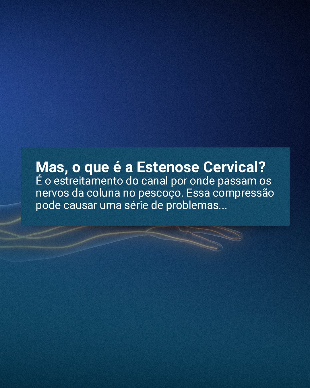 Dor e rigidez no pescoço? Pode ser Estenose Cervical!