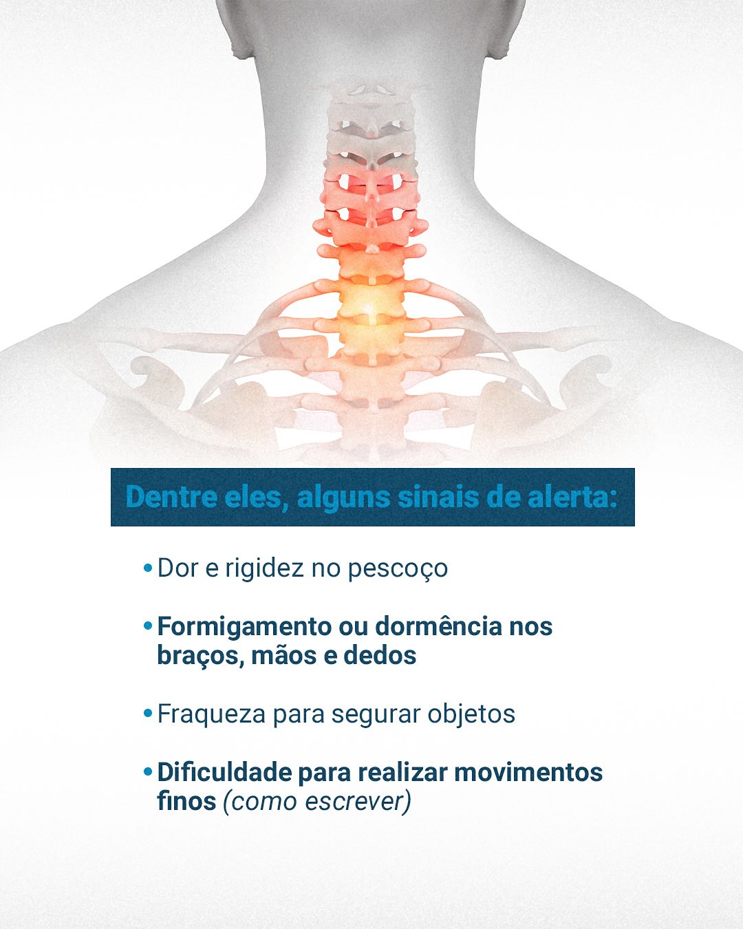 Dor e rigidez no pescoço? Pode ser Estenose Cervical!