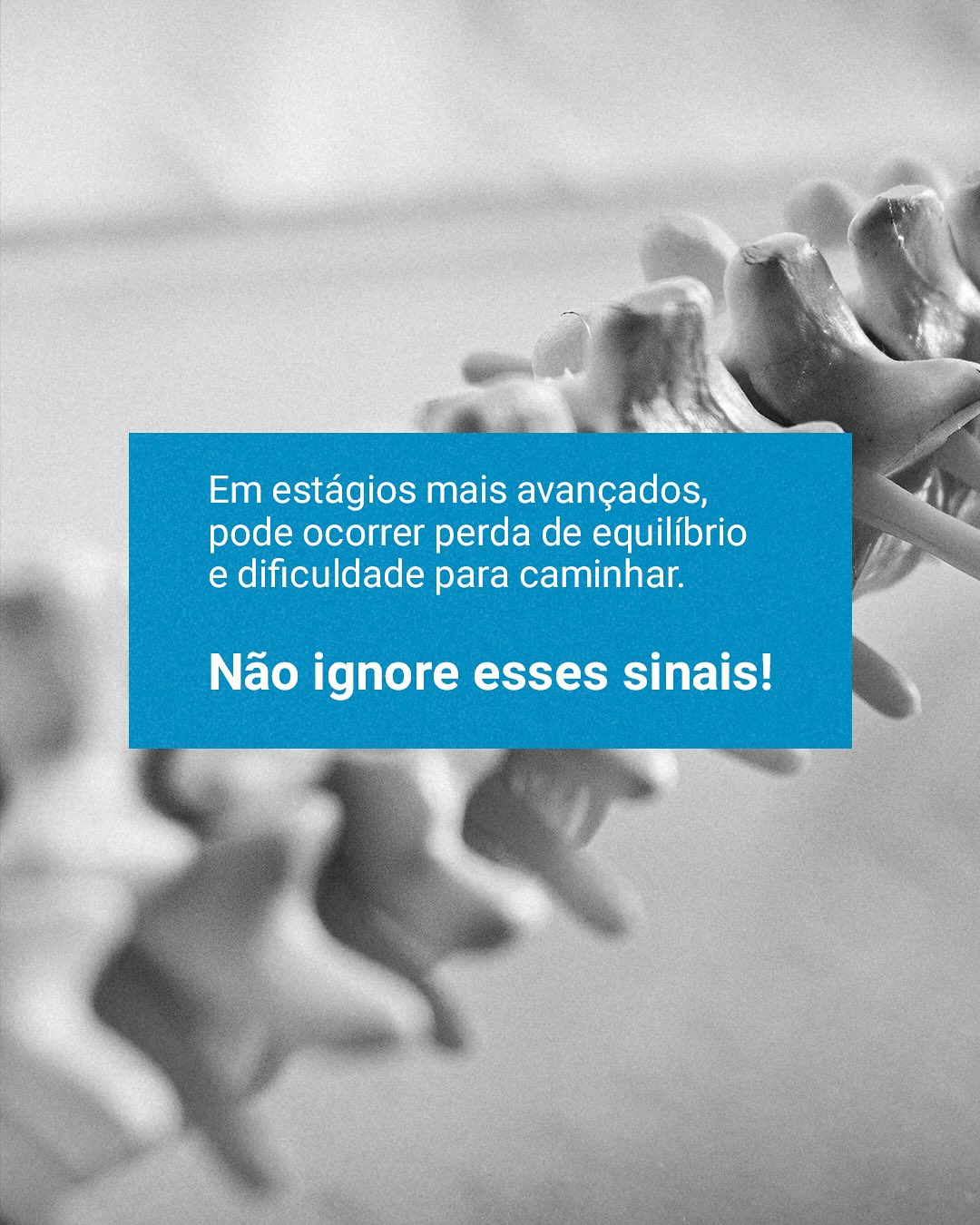 Dor e rigidez no pescoço? Pode ser Estenose Cervical!