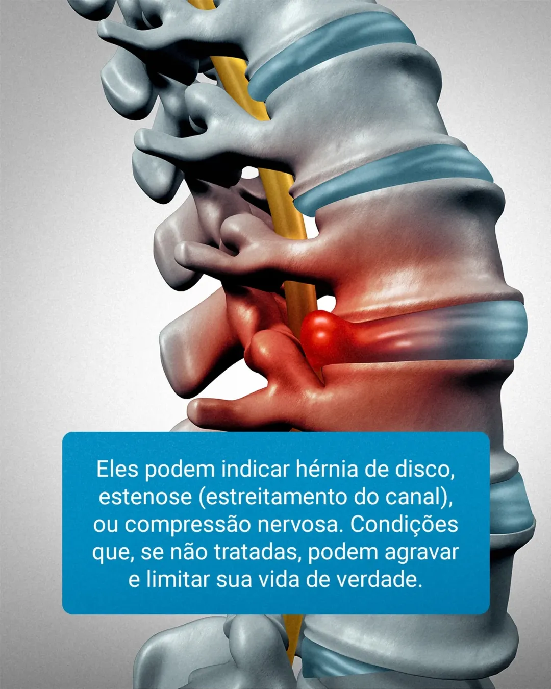 Aquela dor nas costas que sempre volta... Você já convenceu que ela faz parte da sua rotina?