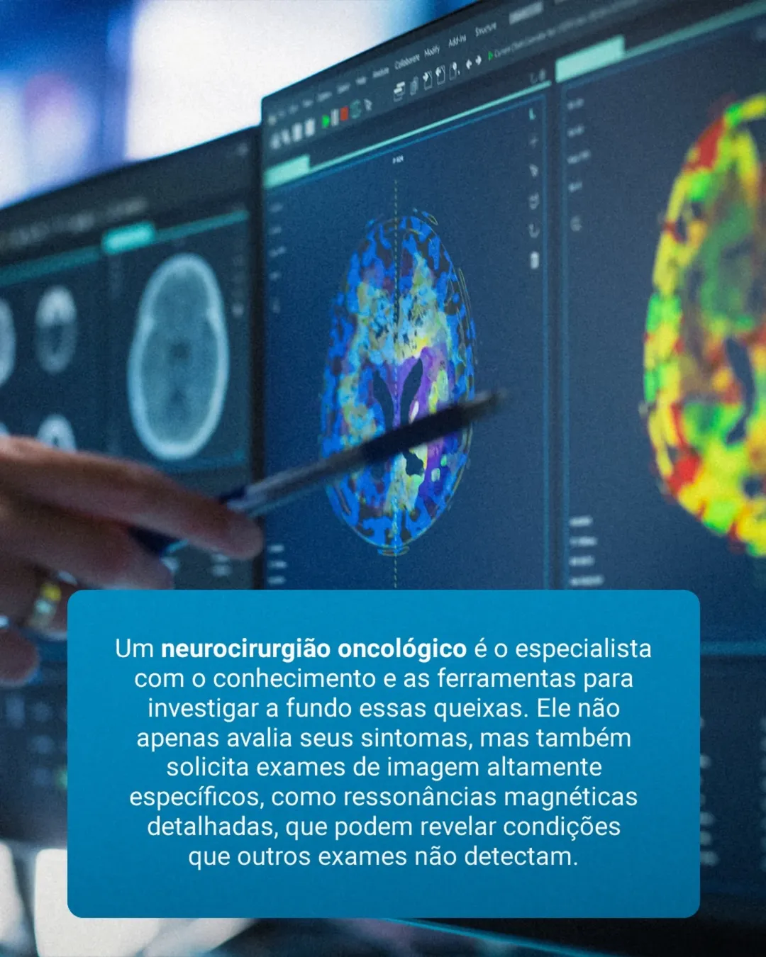 Exames normais, mas os sintomas continuam. Quando procurar um neurocirurgião oncológico?