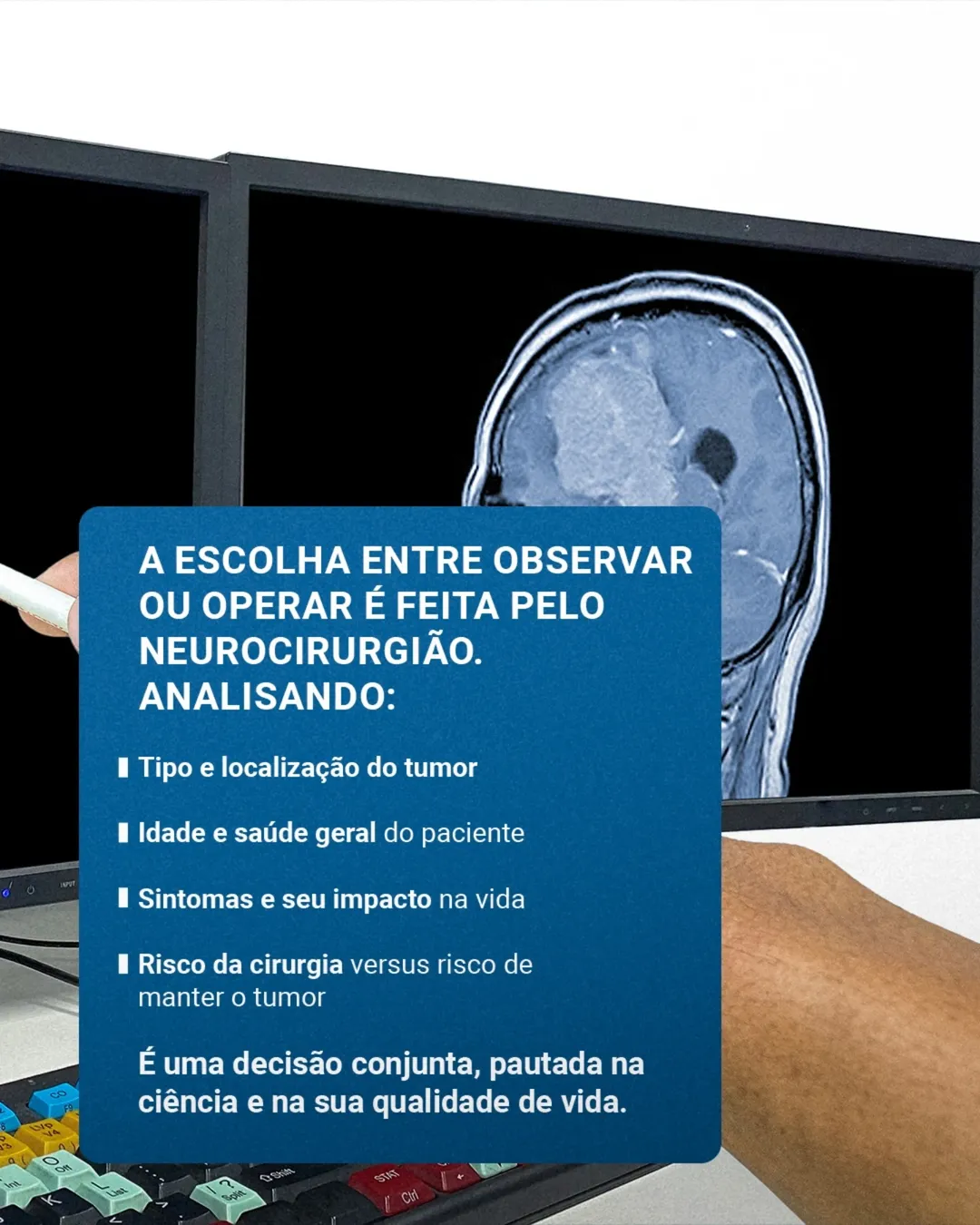 Meningioma: Descobri e agora? Acompanhar ou Operar?