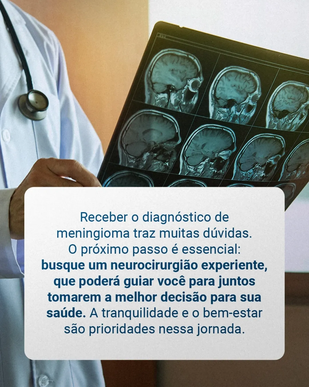 Meningioma: Descobri e agora? Acompanhar ou Operar?