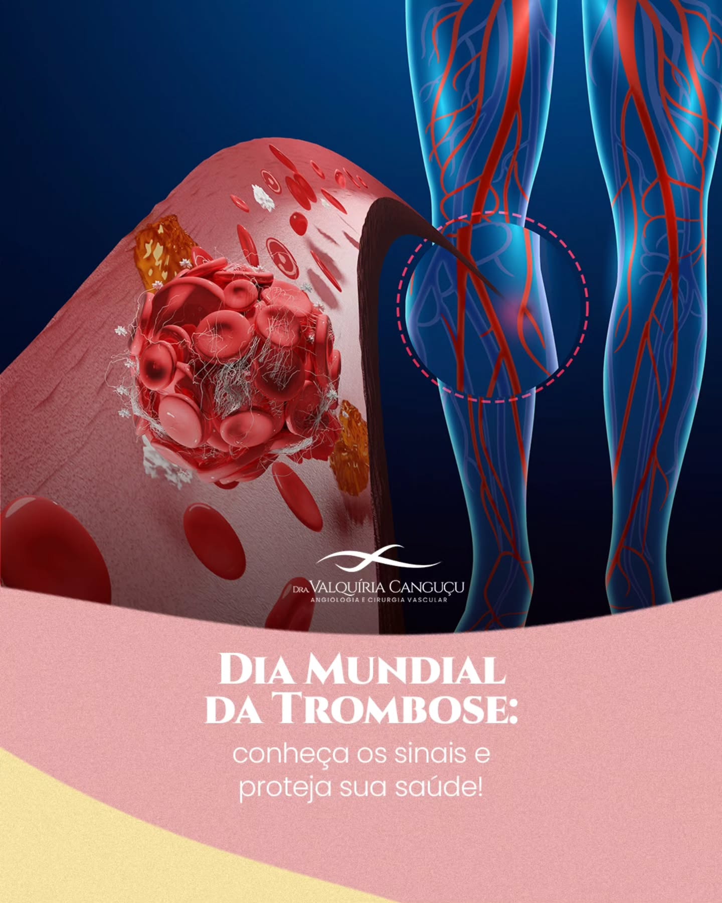 Dia Mundial  da Trombose