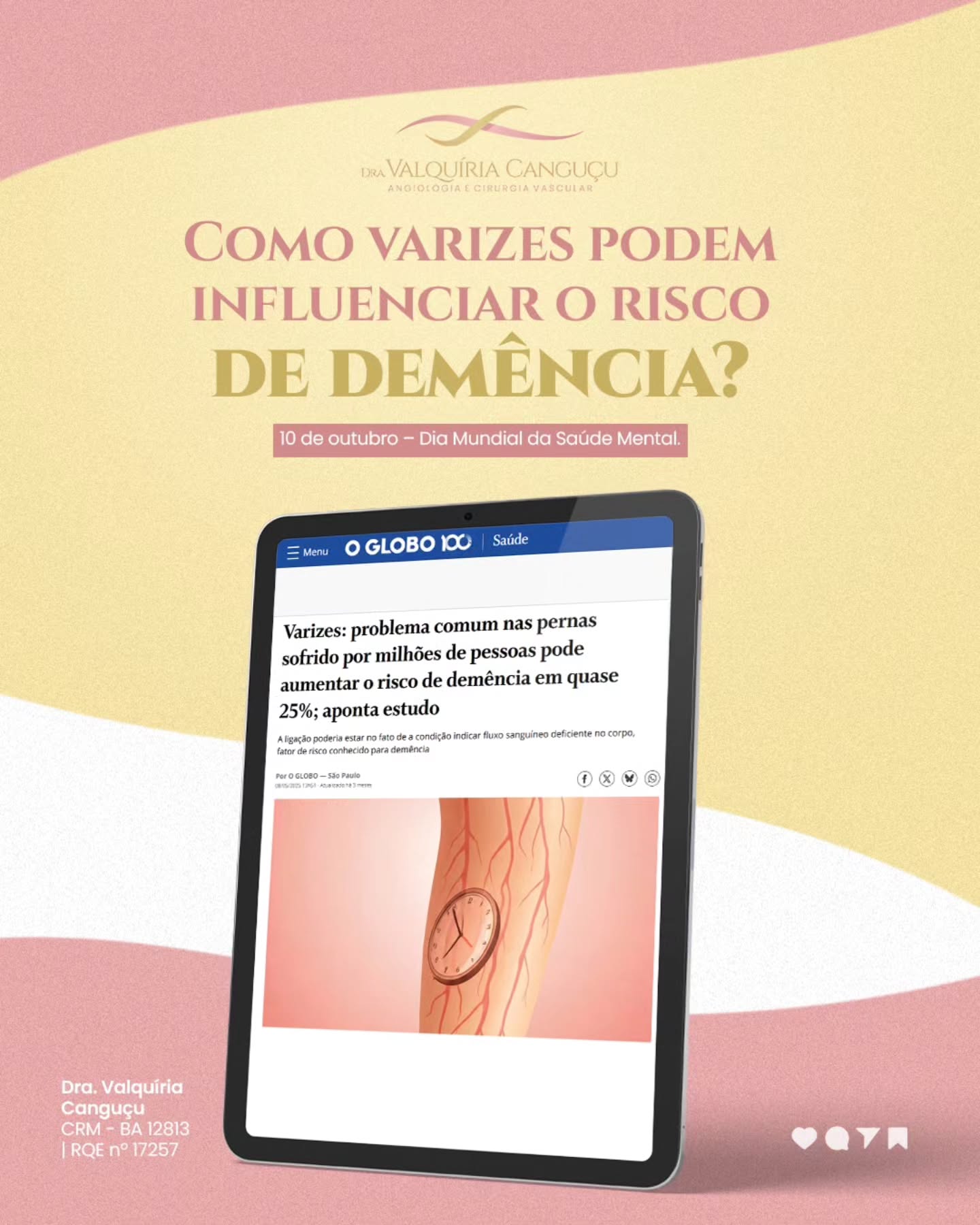 Você sabia que varizes podem aumentar o risco de demência?